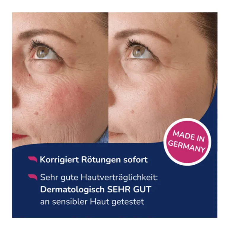 Allergika Anti-Rötung Getöntes Tagesfluid LSF 50+, 30 ml