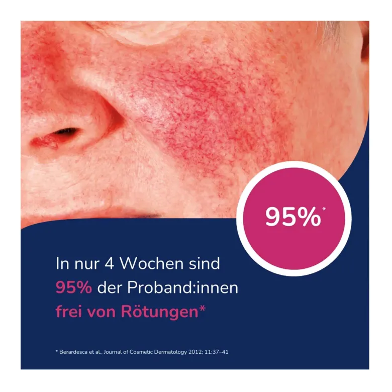 Allergika Anti-Rötung Rosacea Creme MED, 30 ml