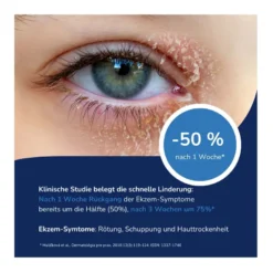 Allergika Augenlidcreme MED, 15 ml