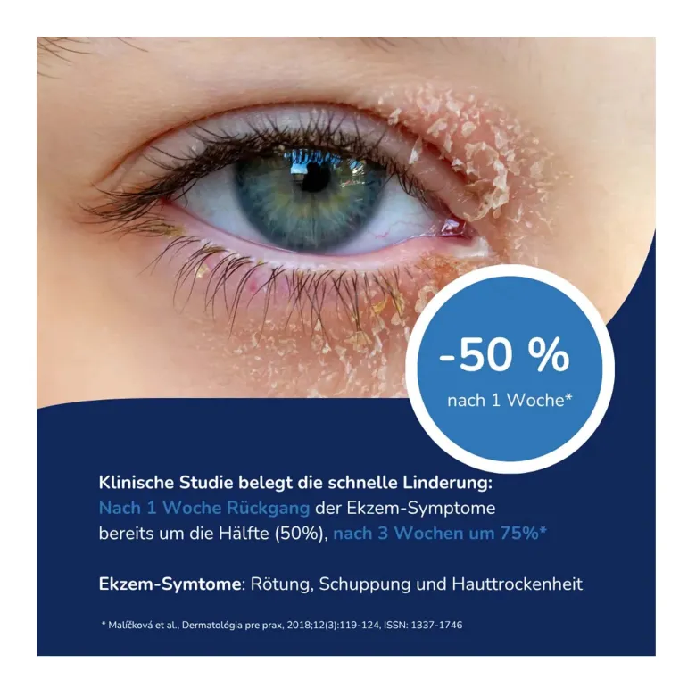 Allergika Augenlidcreme MED, 15 ml