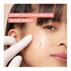 Avene Cleanance Comedomed Anti-Unreinheiten Konzentrat, 30 ml