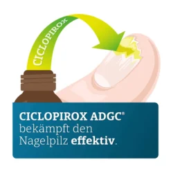 Ciclopirox Adgc 80 mg/g wirkstoffhaltiger Nagellack, 3.3 ml