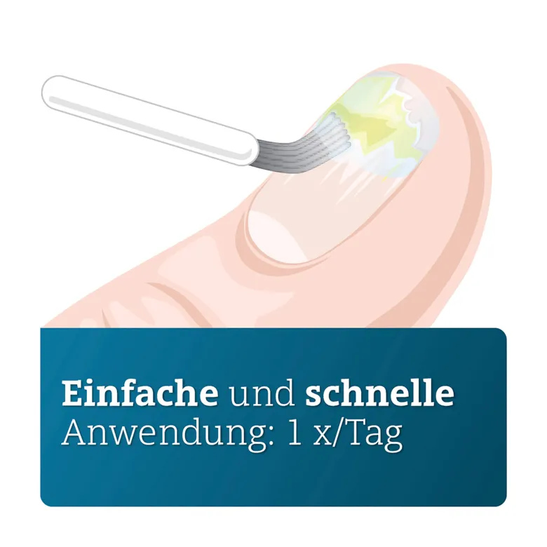 Ciclopirox Adgc 80 mg/g wirkstoffhaltiger Nagellack, 3.3 ml