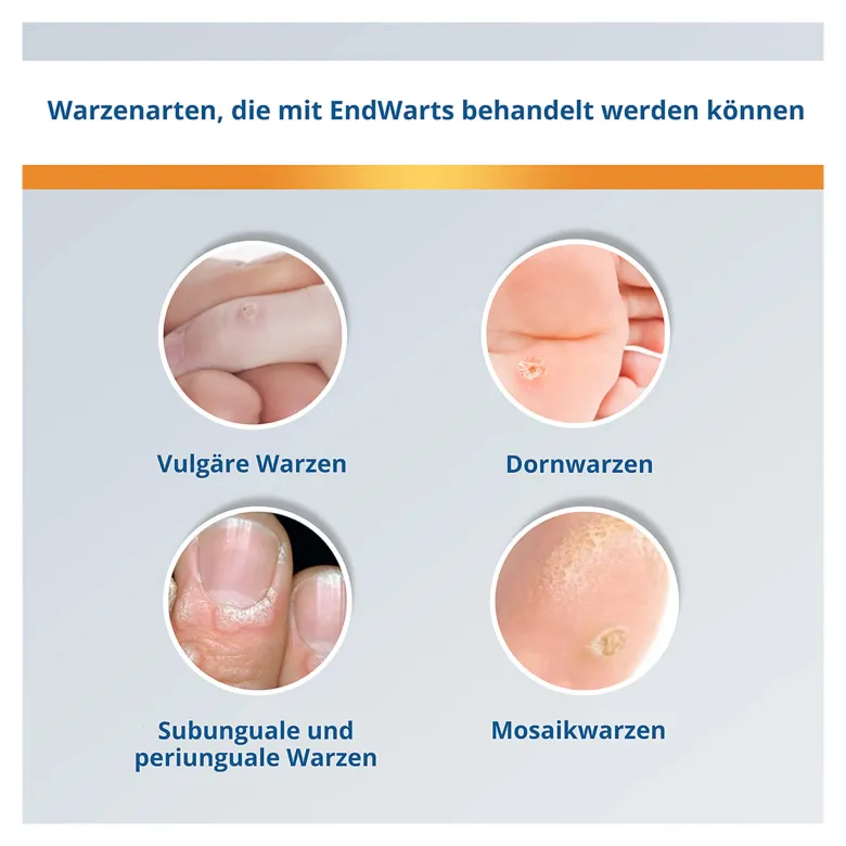 EndWarts Classic Lösung, 3 ml