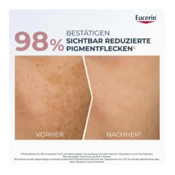 Eucerin Anti-Pigment Dual Serum, 30 ml