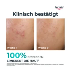 Eucerin DermoPure Clinical Klärendes Tonic, 200 ml