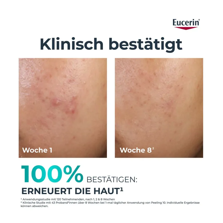 Eucerin DermoPure Clinical Peeling 10 Nachtpflege, 40 ml
