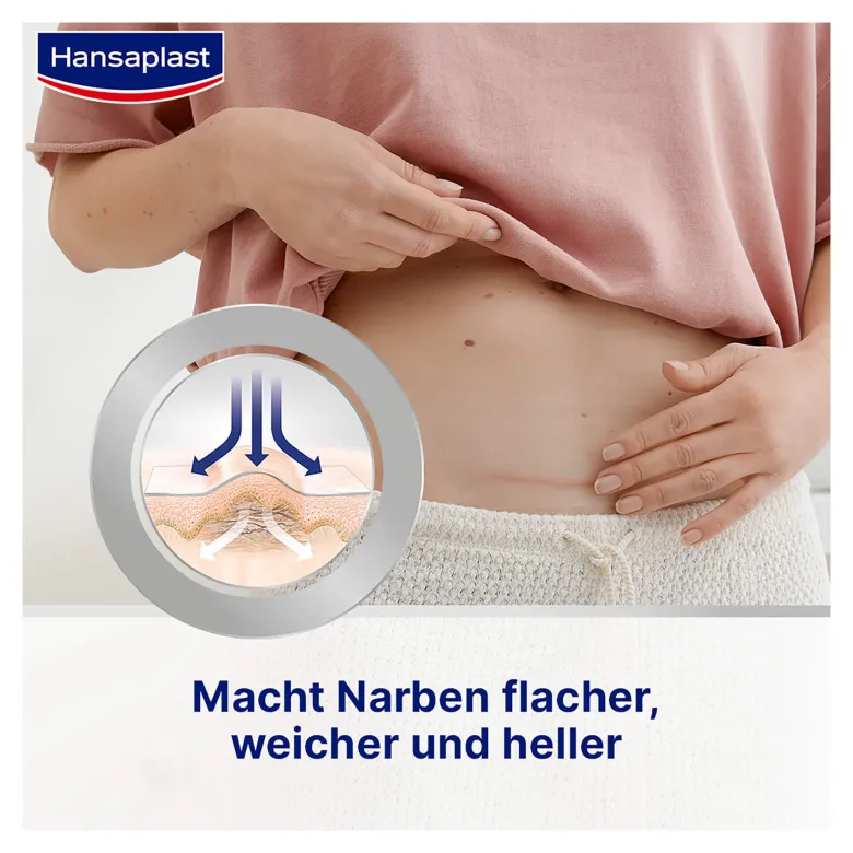 Hansaplast Pflaster zur Behandlung von Narben, 21 St