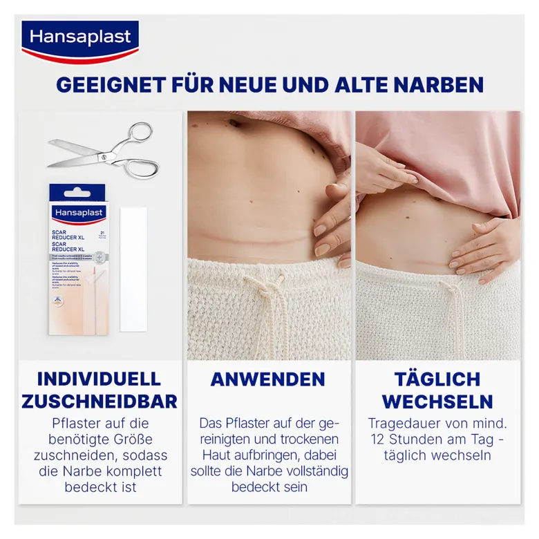 Hansaplast Pflaster zur Behandlung von großen Narben XL, 21 St