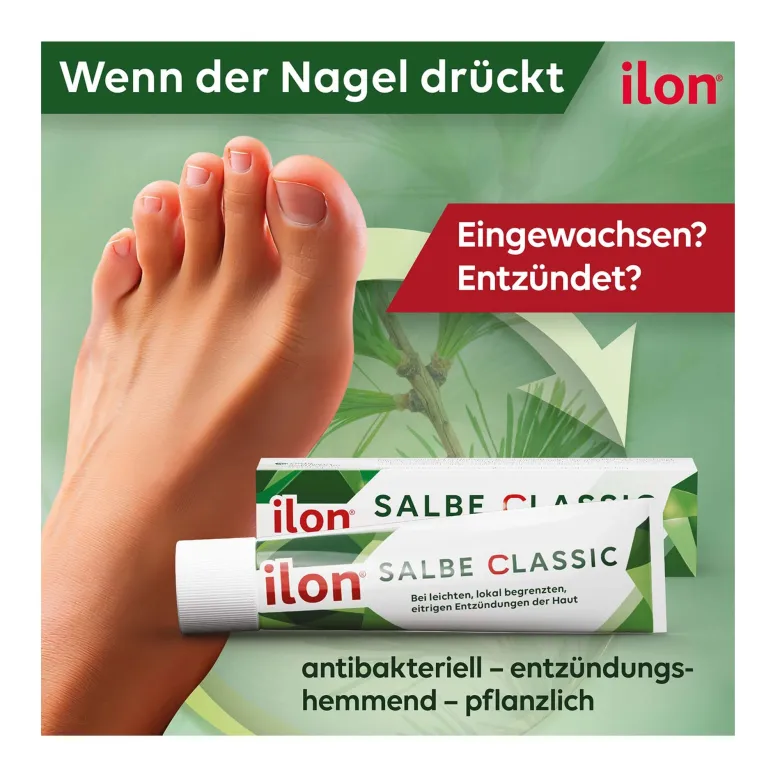 Ilon Salbe classic bei leichten Entzündungen der Haut, 50 g