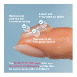 Kelo-Cote Narbengel, 15 g