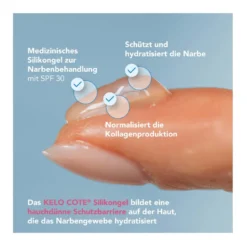 Kelo-Cote Narbengel UV, 6 g