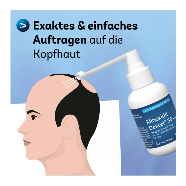Minoxidil Dexcel 50 mg/ml Spray, 60 ml