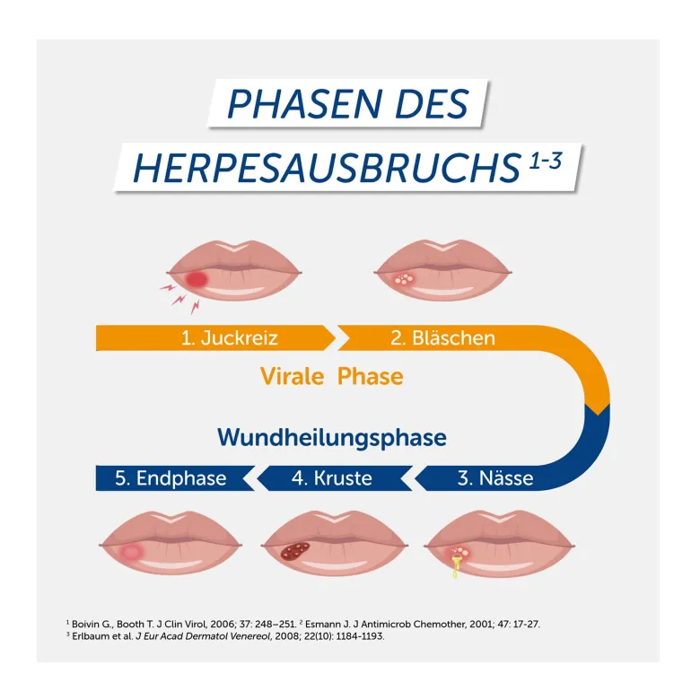 Pencivir Creme bei Lippenherpes, 2 g