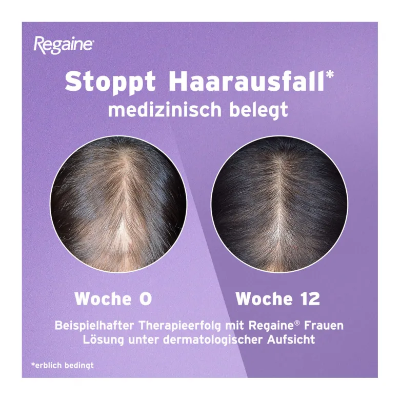 Regaine Frauen Lösung, 3X60 ml
