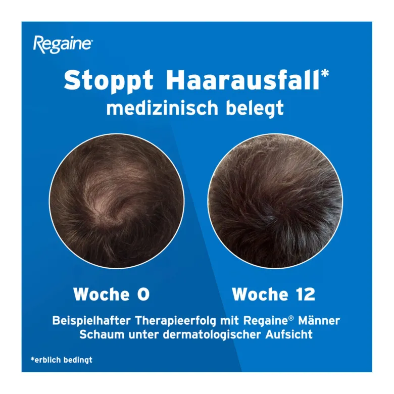 Regaine Männer Lösung, 3X60 ml