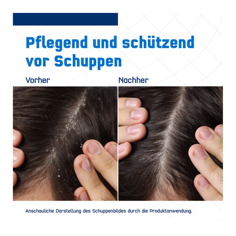 Terzolin Expert Shampoo bei fettiger Kopfhaut, 200 ml
