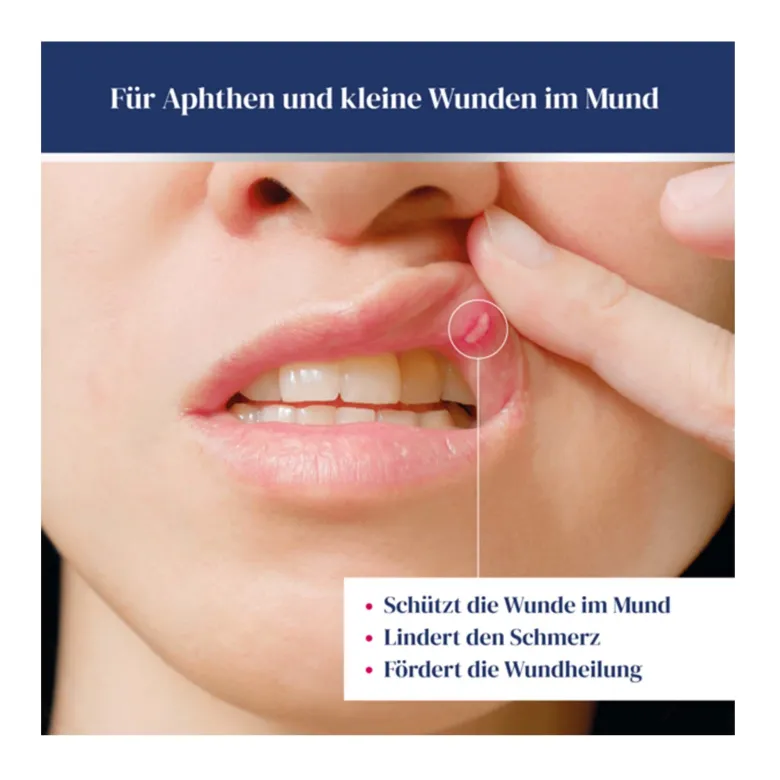 Urgo Aphthen Gel Junior, 8 ml