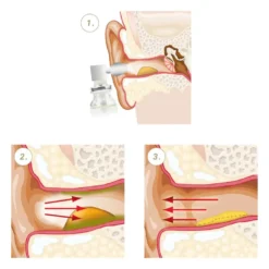 Vaxol Ohrenspray, 10 ml
