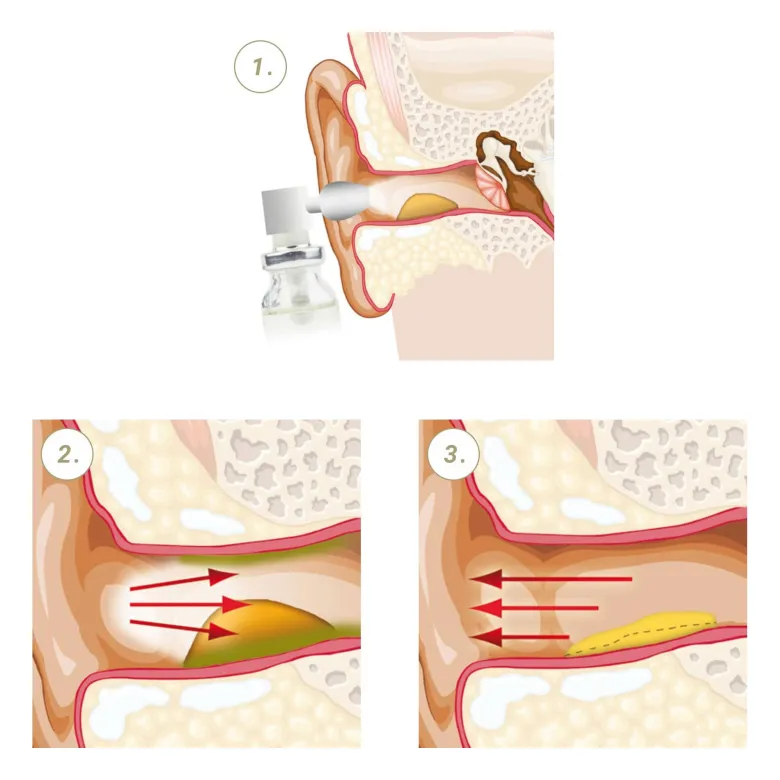 Vaxol Ohrenspray, 10 ml
