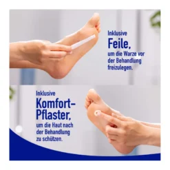 Wartner gegen Fußwarzen Vereisungsmethode, 50 ml