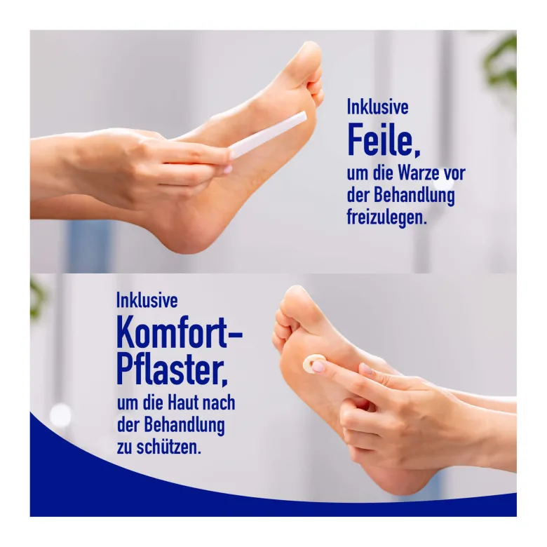 Wartner gegen Fußwarzen Vereisungsmethode, 50 ml