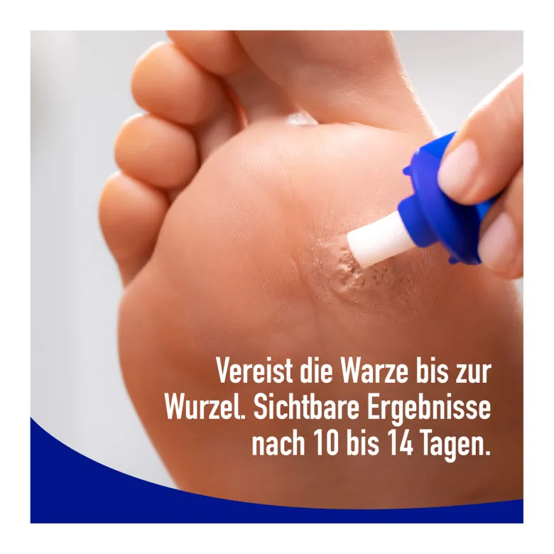 Wartner gegen Fußwarzen Vereisungsmethode, 50 ml